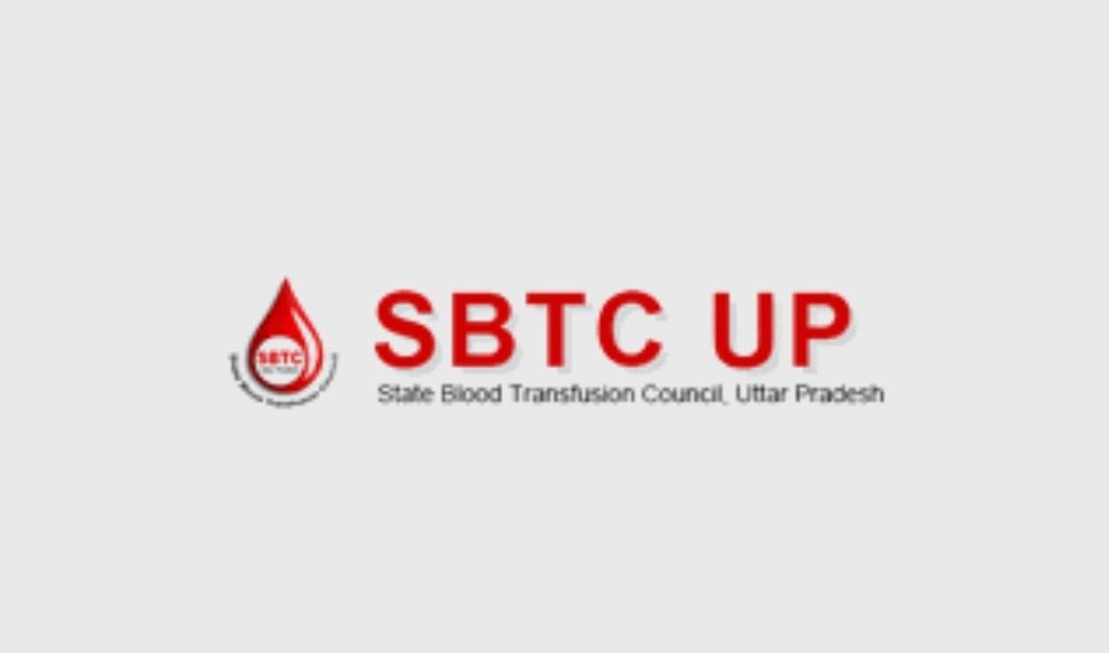 SBTC UP